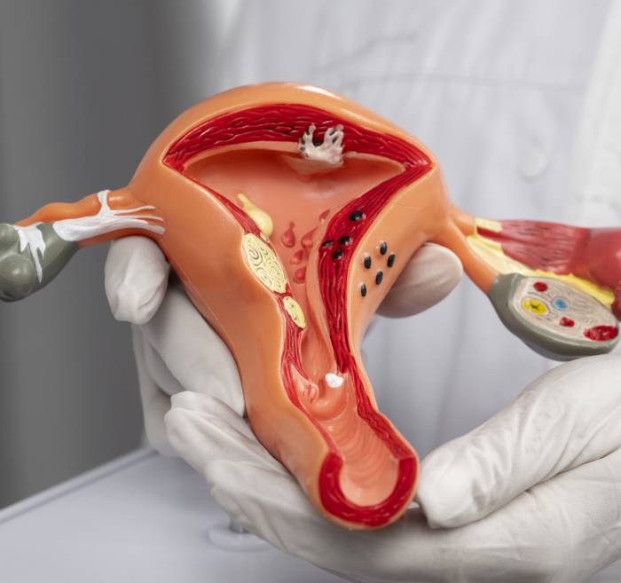 Dr. Ginecólogo CDMX