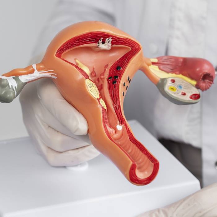 Médico Ginecólogo en CDMX