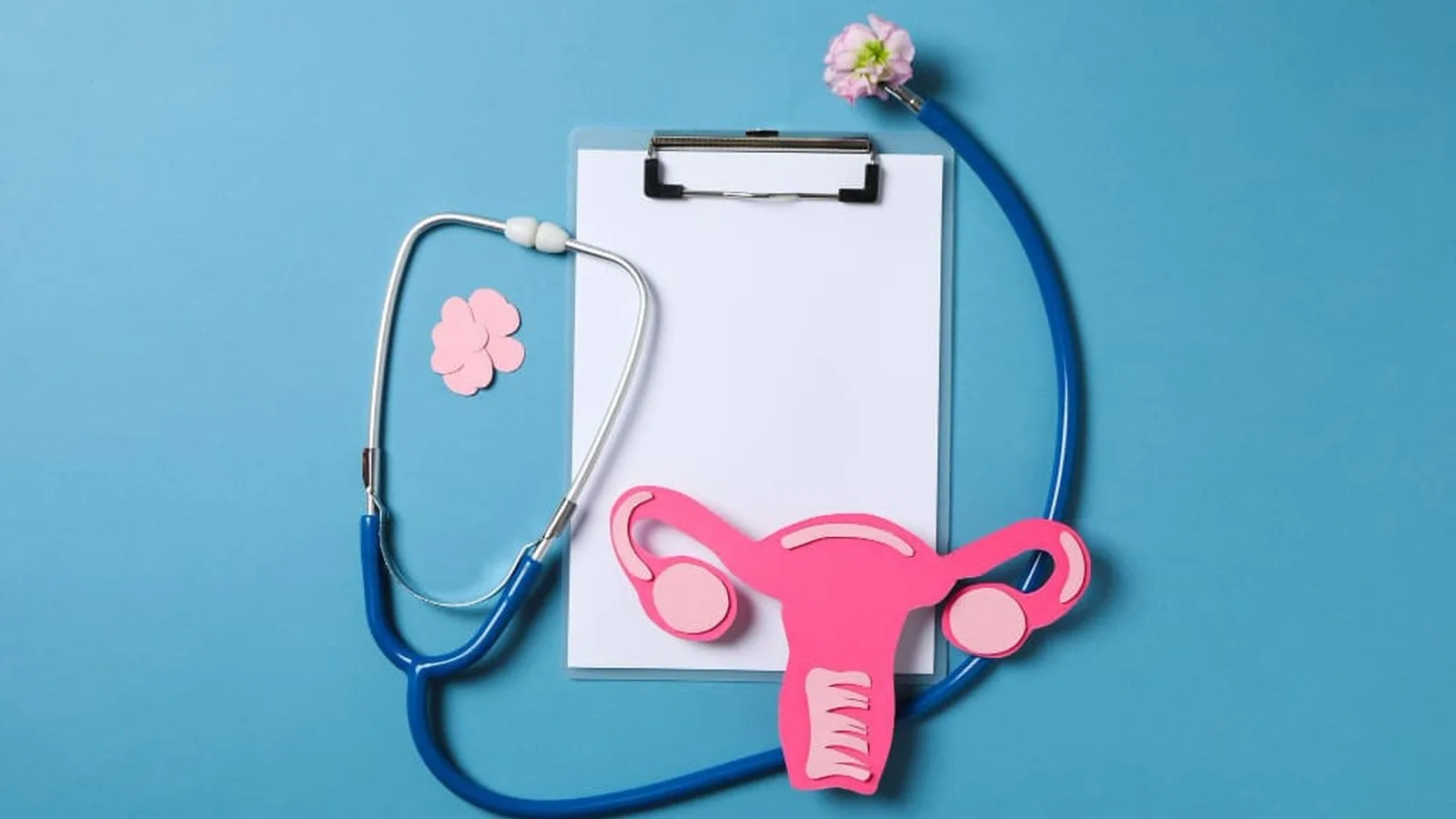 ¿Cómo se diagnostica y trata la endometriosis en CDMX?